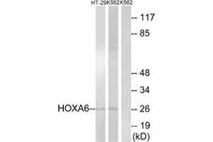 Western blot analysis of extracts from HT-29/K562 cells, using HOXA6 Antibody. (HOXA6 antibody  (AA 101-150))