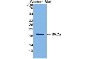Western Blotting (WB) image for anti-Sonic Hedgehog (SHH) (AA 28-192) antibody (ABIN1175088) (Sonic Hedgehog antibody  (AA 28-192))