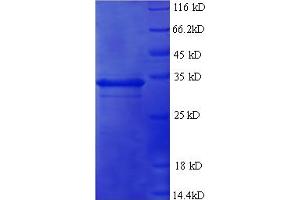 SDS-PAGE (SDS) image for Tumor Necrosis Factor-Inducible Protein 6 (TNFAIP6) (AA 18-277) protein (His tag) (ABIN5710520) (TNFAIP6 Protein (AA 18-277) (His tag))