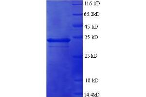 SDS-PAGE (SDS) image for Tumor Necrosis Factor-Inducible Protein 6 (TNFAIP6) (AA 18-277) protein (His tag) (ABIN4975927)