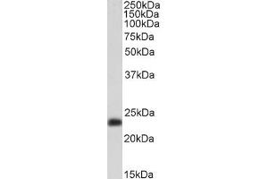 Western Blotting (WB) image for anti-Transgelin (TAGLN) (C-Term) antibody (ABIN185188)