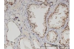 Image no. 1 for anti-Mediator Complex Subunit 6 (MED6) (AA 1-247) antibody (ABIN599504) (MED6 antibody  (AA 1-247))