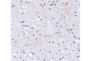 Immunohistochemical staining of human brain tissue using FBXL20 polyclonal antibody  at 2. (FBXL20 antibody  (C-Term))