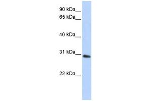 WB Suggested Anti-BPGM Antibody Titration: 0. (BPGM antibody  (C-Term))