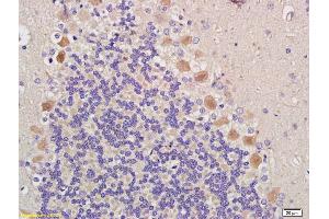 Formalin-fixed and paraffin embedded rat brain (epencephala tissue labeled with Anti-RORB/ROR beta Polyclonal Antibody, Unconjugated (ABIN715871) at 1:200 followed by conjugation to the secondary antibody (RORB antibody  (AA 385-470))