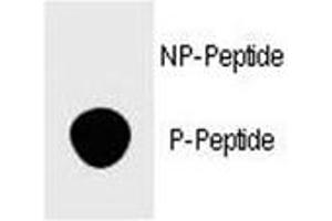 Dot blot analysis of phospho-FOXP3 antibody. (FOXP3 antibody  (pSer418))