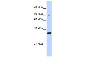 LRRC57 antibody used at 1 ug/ml to detect target protein. (LRRC57 antibody  (N-Term))