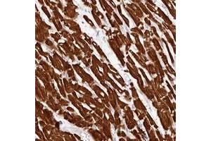 Immunohistochemical staining of human heart muscle with MYH15 polyclonal antibody  shows strong cytoplasmic positivity in myocytes. (MYH15 antibody)