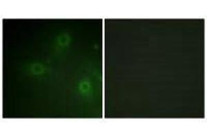 Immunofluorescence analysis of HeLa cells, using Neutrophil Cytosol Factor 1 (Ab-304) antibody. (NCF1 antibody  (Ser304))