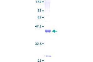 WFDC5 Protein (AA 1-123) (GST tag)