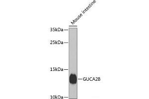 Western blot analysis of extracts of Mouse small intestine using GUCA2B Polyclonal Antibody at dilution of 1:1000. (GUCA2B antibody)