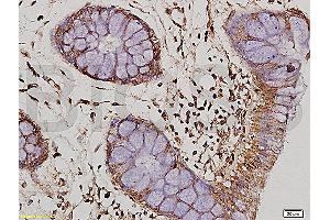 Formalin-fixed and paraffin embedded human colon tissue labeled Anti-IL-10 Polyclonal Antibody, Unconjugated (ABIN672051) at 1:200, followed by conjugation to the secondary antibody and DAB staining (IL-10 antibody  (AA 101-178))