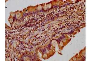 IHC image of ABIN7171569 diluted at 1:300 and staining in paraffin-embedded human small intestine tissue performed on a Leica BondTM system. (TMF1 antibody  (AA 878-986))