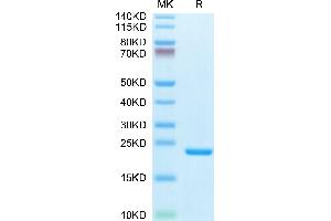 IL-1 beta Protein (AA 117-269) (His-Avi Tag,Biotin)