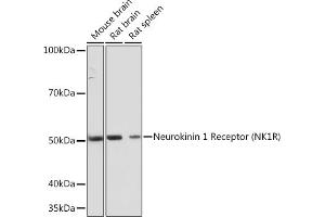 Western blot analysis of extracts of various cell lines, using Neurokinin 1 Receptor (NK1R) (NK1R) Rabbit mAb (ABIN7270711) at 1:1000 dilution. (TACR1 antibody)