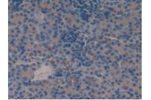 Detection of VIP in Mouse Kidney Tissue using Polyclonal Antibody to Vasoactive Intestinal Peptide (VIP) (Vip antibody  (AA 28-159))