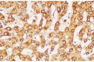Immunohistochemistry of paraffin-embedded Human liver using FGG Polycloanl Antibody at dilution of 1:200 (FGG antibody)