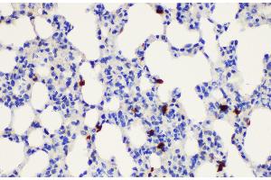 Immunohistochemistry of paraffin-embedded Rat lung using S100a8 Polycloanl Antibody at dilution of 1:200 (S100A8 antibody)