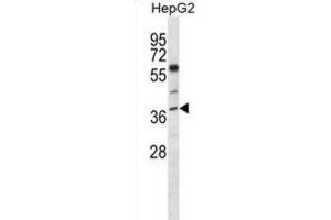 Western Blotting (WB) image for anti-Endonuclease 8-like 2 (NEIL2) antibody (ABIN5018074)