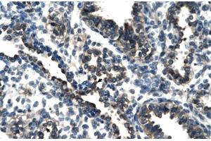 Rabbit Anti-TSC22D4 Antibody Catalog Number: ARP30107 Paraffin Embedded Tissue: Human Lung Cellular Data: Alveolar cells Antibody Concentration: 4. (TSC22D4 antibody  (N-Term))