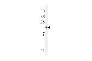 Western blot analysis in mouse liver tissue lysates (35ug/lane). (hCG_2024410 (AA 187-215), (C-Term) antibody)