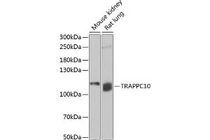 Western blot analysis of extracts of various cell lines, using TR antibody (ABIN6129150, ABIN6149471, ABIN6149472 and ABIN6222518) at 1:1000 dilution. (TRAPPC10 antibody  (AA 1-260))