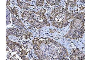 IHC analysis of TFEB using anti-TFEB antibody (ABIN7600648). (TFEB antibody  (AA 214-326))