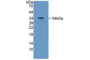 Detection of Recombinant Tyk2, Human using Polyclonal Antibody to Tyrosine Kinase 2 (Tyk2) (TYK2 antibody  (AA 915-1173))
