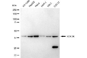 Western blotting analysis using BCKDK antibody (ABIN7797783). (BCKDK antibody)