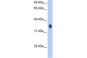 Western Blotting (WB) image for anti-Solute Carrier Family 35, Member F2 (SLC35F2) antibody (ABIN2462757) (SLC35F2 antibody)