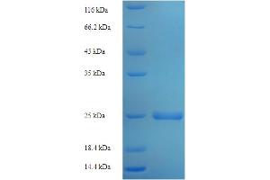 SDS-PAGE (SDS) image for Stromal Cell Derived Factor 2 (SDF2) (AA 19-211) protein (His tag) (ABIN5710324)