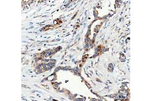 IHC analysis of FOXO3A using anti-FOXO3A antibody (ABIN3042404). (FOXO3 antibody  (AA 471-673))