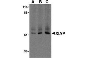 Western blot analysis of XIAP in Human kidney lysate using AP30993PU-N XIAP antibody at 0. (XIAP antibody  (C-Term))