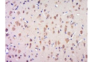 Paraformaldehyde-fixed, paraffin embedded rat brain tissue, Antigen retrieval by boiling in sodium citrate buffer(pH6) for 15min, Block endogenous peroxidase by 3% hydrogen peroxide for 30 minutes, Blocking buffer (normal goat serum) at 37°C for 20min, Antibody incubation with Rabbit Anti-CCDC124 Polyclonal Antibody, Unconjugated  at 1:500 overnight at 4°C, followed by a conjugated secondary and DAB staining (CCDC124 antibody  (AA 145-223))