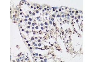 Immunohistochemistry of paraffin-embedded Rat testis using CASC5 Polyclonal Antibody at dilution of 1:100 (40x lens). (CASC5 antibody)