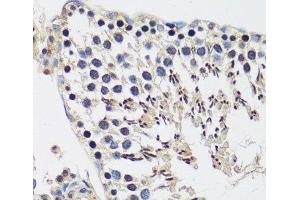 Immunohistochemistry of paraffin-embedded Rat testis using CASC5 Polyclonal Antibody at dilution of 1:100 (40x lens).