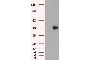 Image no. 1 for anti-CUGBP, Elav-Like Family Member 1 (CELF1) antibody (ABIN1497686) (CELF1 antibody)