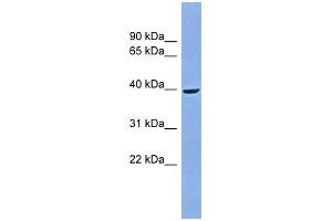 ACPP antibody used at 1 ug/ml to detect target protein. (ACPP antibody  (Middle Region))
