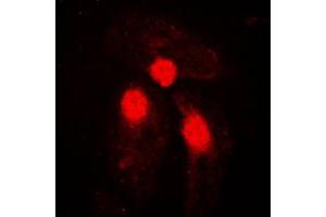 Immunofluorescent analysis of SMAD3 (pS204) staining in HeLa cells. (SMAD3 antibody  (pSer204))