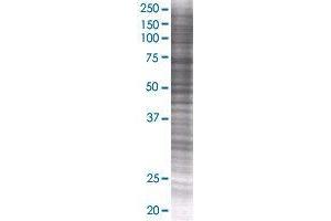 EPAS1 transfected lysate. (EPAS1 293T Cell Transient Overexpression Lysate(Denatured))