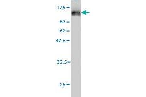 Western Blot detection against Immunogen (120. (TOP3B antibody  (AA 1-862))