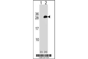Western blot analysis of UBE2T using rabbit polyclonal UBE2T Antibody using 293 cell lysates (2 ug/lane) either nontransfected (Lane 1) or transiently transfected (Lane 2) with the UBE2T gene. (Ube2t antibody  (C-Term))
