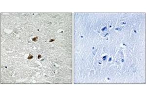 Immunohistochemistry analysis of paraffin-embedded human brain, using HSF1 (Phospho-Ser121) Antibody. (HSF1 antibody  (pSer121))