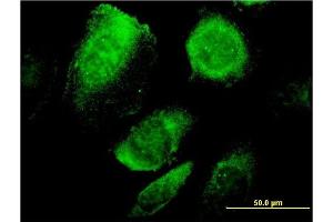 Immunofluorescence of monoclonal antibody to BCAP29 on HeLa cell. (BCAP29 antibody  (AA 125-241))
