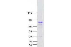 Validation with Western Blot (UGT2A1 Protein (Myc-DYKDDDDK Tag))