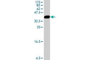 Western Blot detection against Immunogen (34. (AP1M1 antibody  (AA 1-74))