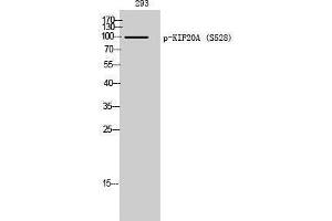 Western Blotting (WB) image for anti-Kinesin Family Member 20A (KIF20A) (pSer528) antibody (ABIN3182270) (KIF20A antibody  (pSer528))