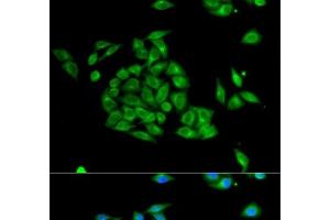 Immunofluorescence analysis of HeLa cells using PICK1 Polyclonal Antibody (PICK1 antibody)