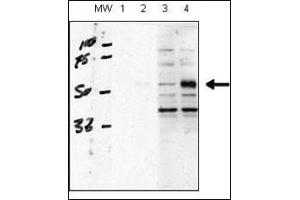 human chondrocytes (C28/I2 cells), transfected with empty vector (lane 1, 3) or ACVRL1(lane 2, 4). (ACVRL1 antibody  (N-Term))