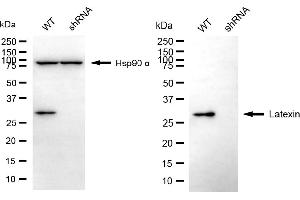Western blotting analysis using latexin antibody (ABIN7799238).